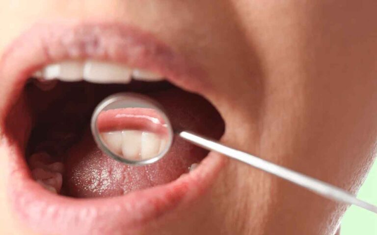 boutton-langue-avis-medical