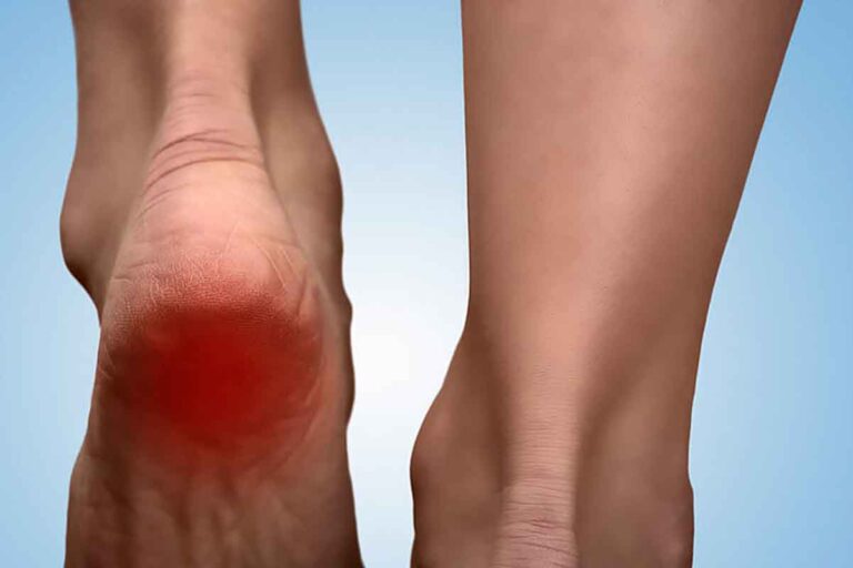 douleur talon gauche signification