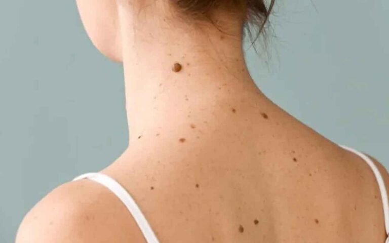 grain-de-beauté